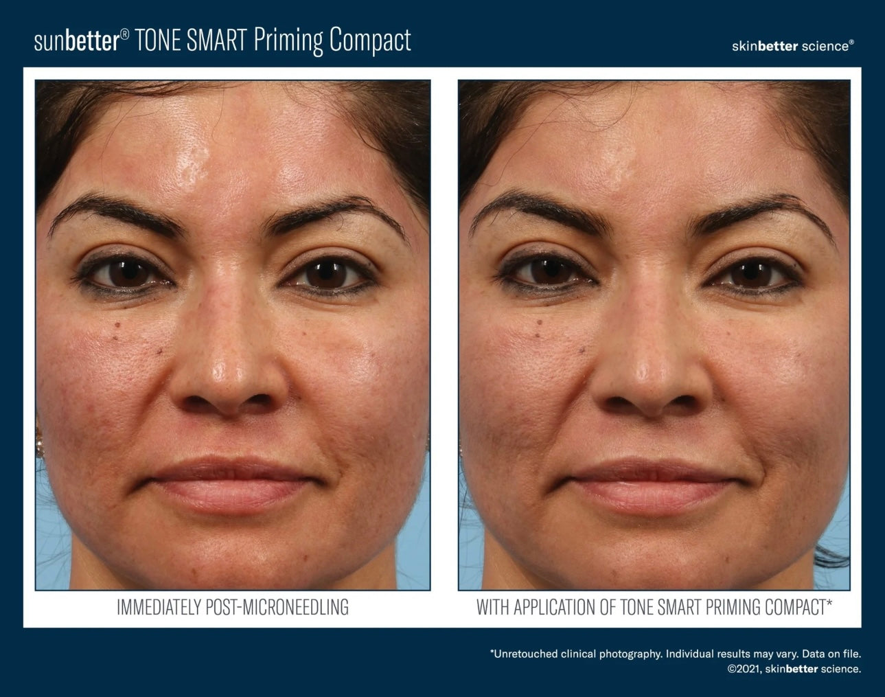 SkinBetter Tone Smart Priming Compact