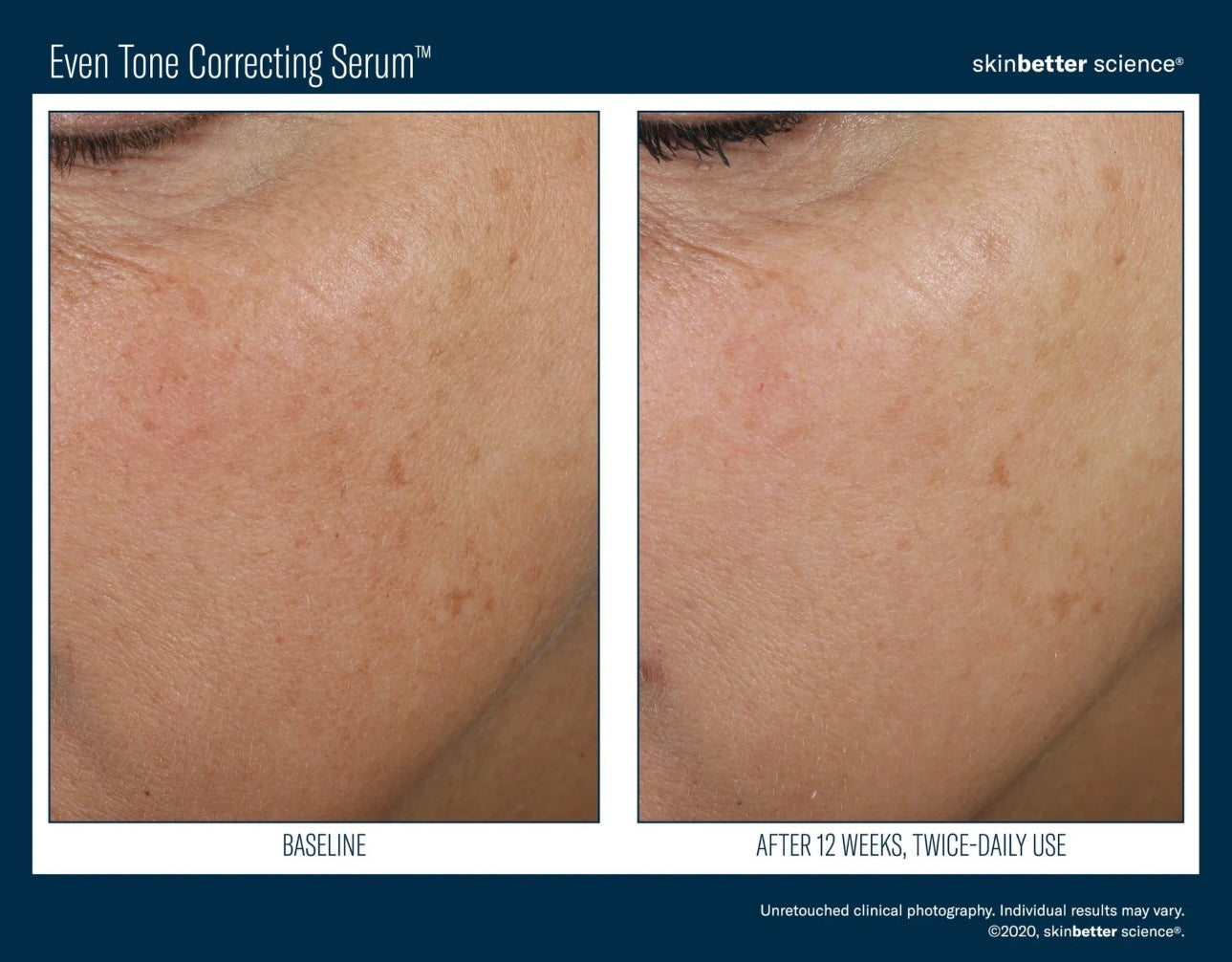 SkinBetter Even Tone Correcting Serum